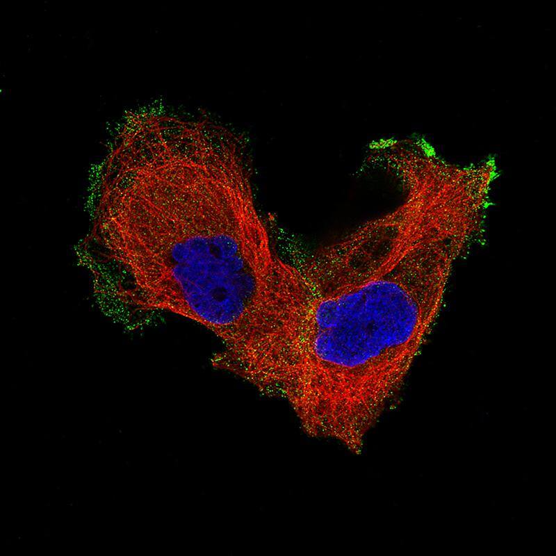 Staining of EFO-21 cells, showing specific staining in the plasma membrane in green. Microtubule- and nuclear probes are visualized in red and blue, respectively (where available).