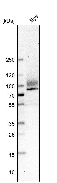 Analysis in human eye tissue.
