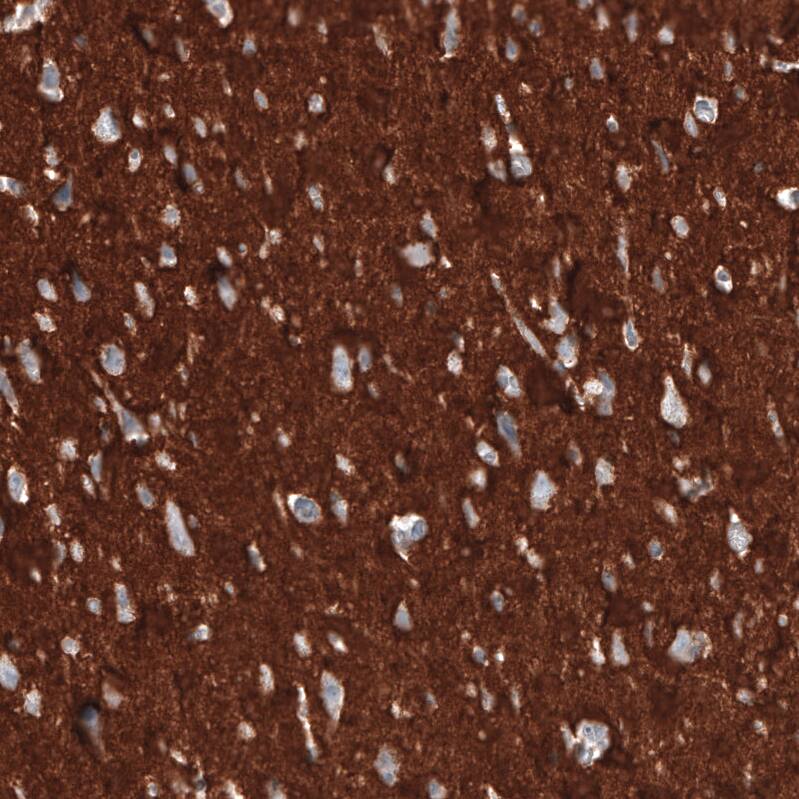 <b>Orthogonal Strategies Validation. </b>Staining of human cerebral cortex shows strong positivity in neuropil.