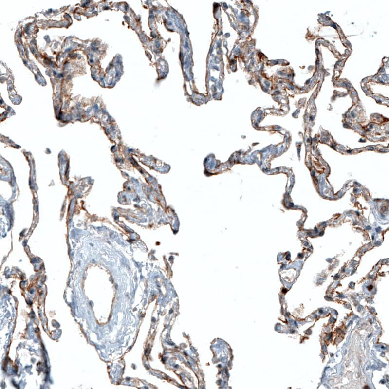 Staining of human lung shows moderate membranous positivity in pneumocytes.