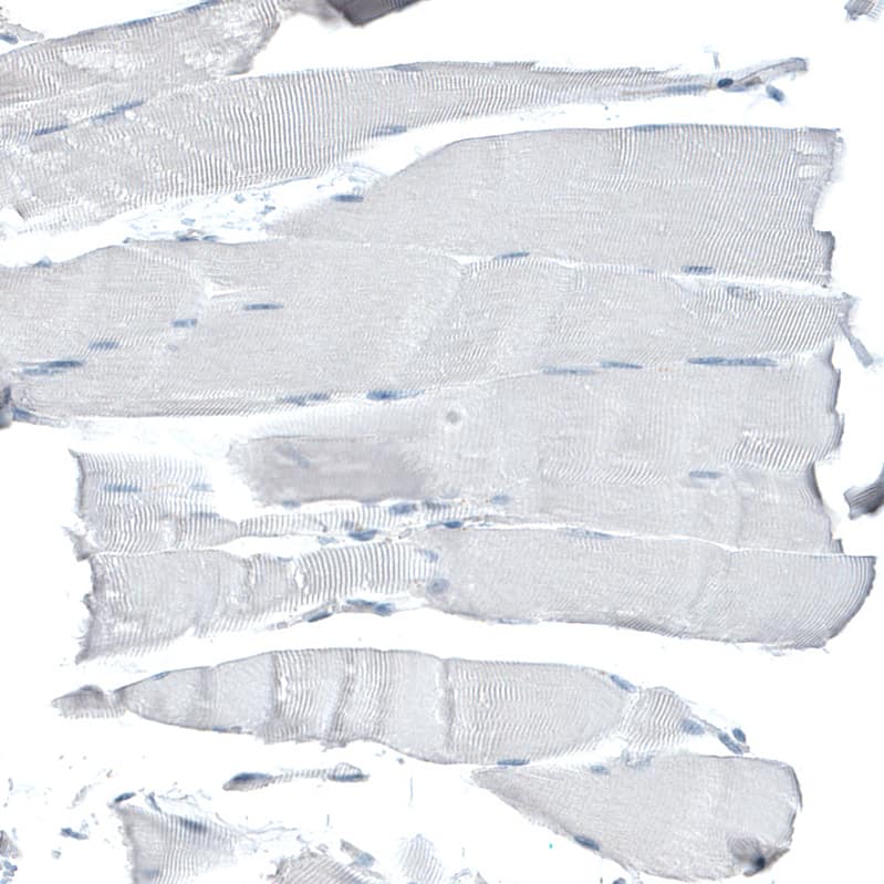 Staining of human skeletal muscle shows no positivity in striated muscle fibers as expected.