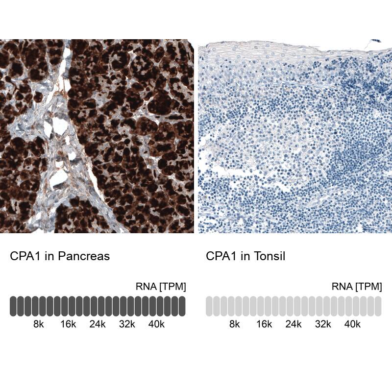 Analysis in human pancreas and tonsil tissues using NBP3-44398 antibody. Corresponding Carboxypeptidase A1/CPA1 RNA-seq data are presented for the same tissues.