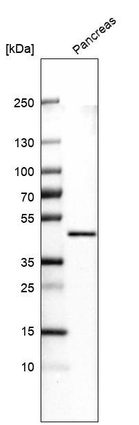 Analysis in human pancreas tissue.