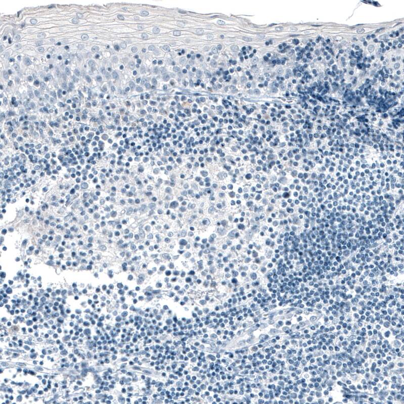 Staining of human tonsil shows no positivity in lymphoid cells as expected.