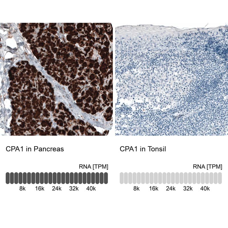 Analysis in human pancreas and tonsil tissues using NBP3-44399 antibody. Corresponding Carboxypeptidase A1/CPA1 RNA-seq data are presented for the same tissues.