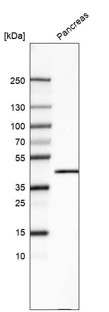 Analysis in human pancreas tissue.