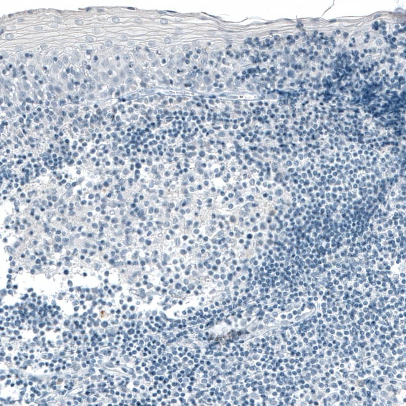 Staining of human tonsil shows no positivity in lymphoid cells as expected.