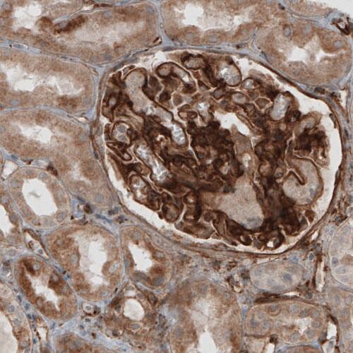 Staining of human kidney shows strong positivity in renal glomeruli.