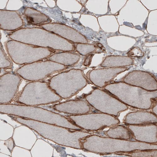 Staining of human skeletal muscle shows strong membranous immunoreactivity in myocytes.