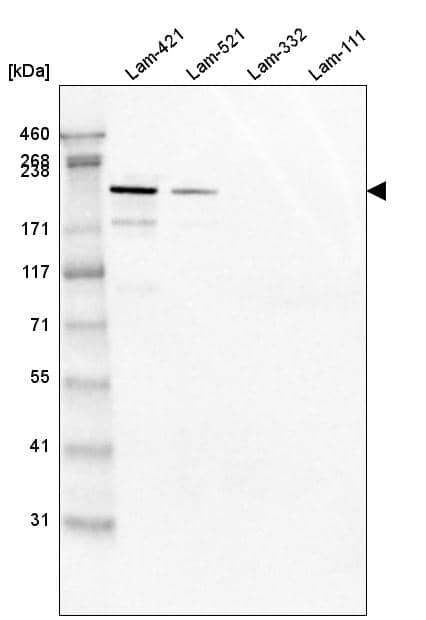 Analysis of purified human recombinant Laminin-421, Laminin-521, Laminin-332 and Laminin-111.