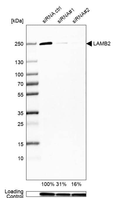 Analysis in U-138MG cells transfected with control siRNA, target specific siRNA probe #1 and #2, using Anti-Laminin S/Laminin beta 2 antibody. Remaining relative intensity is presented. Loading control: Anti-GAPDH.