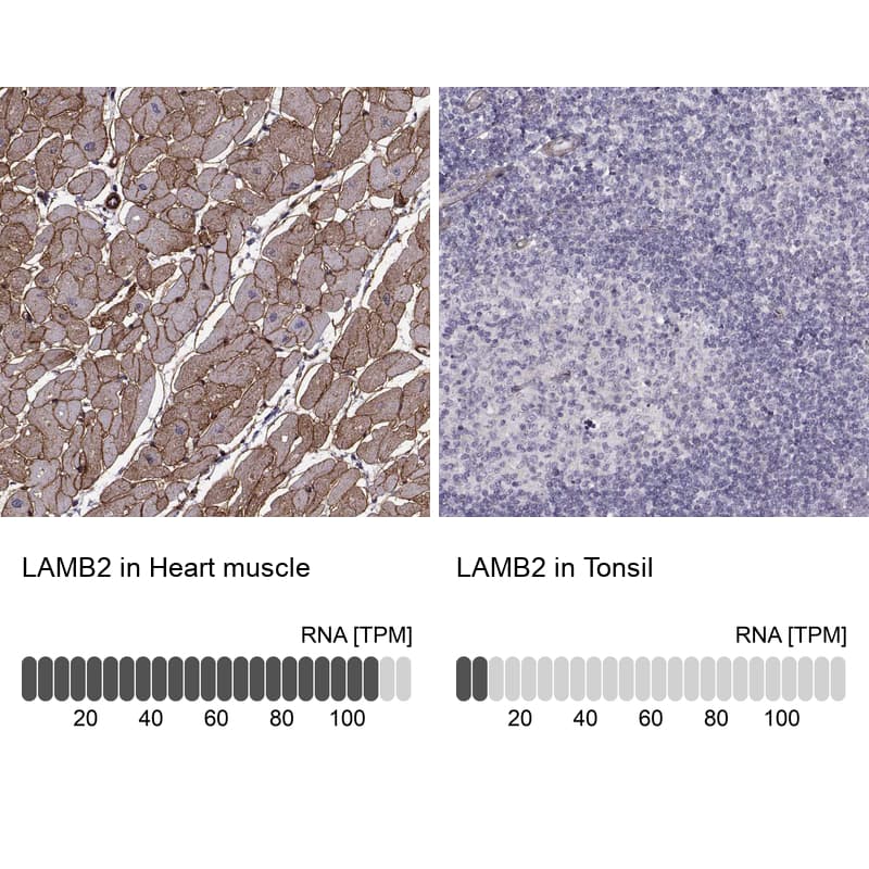 Analysis in human heart muscle and tonsil tissues using NBP3-44401 antibody. Corresponding Laminin S/Laminin beta 2 RNA-seq data are presented for the same tissues.
