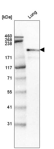 Analysis in human lung tissue.