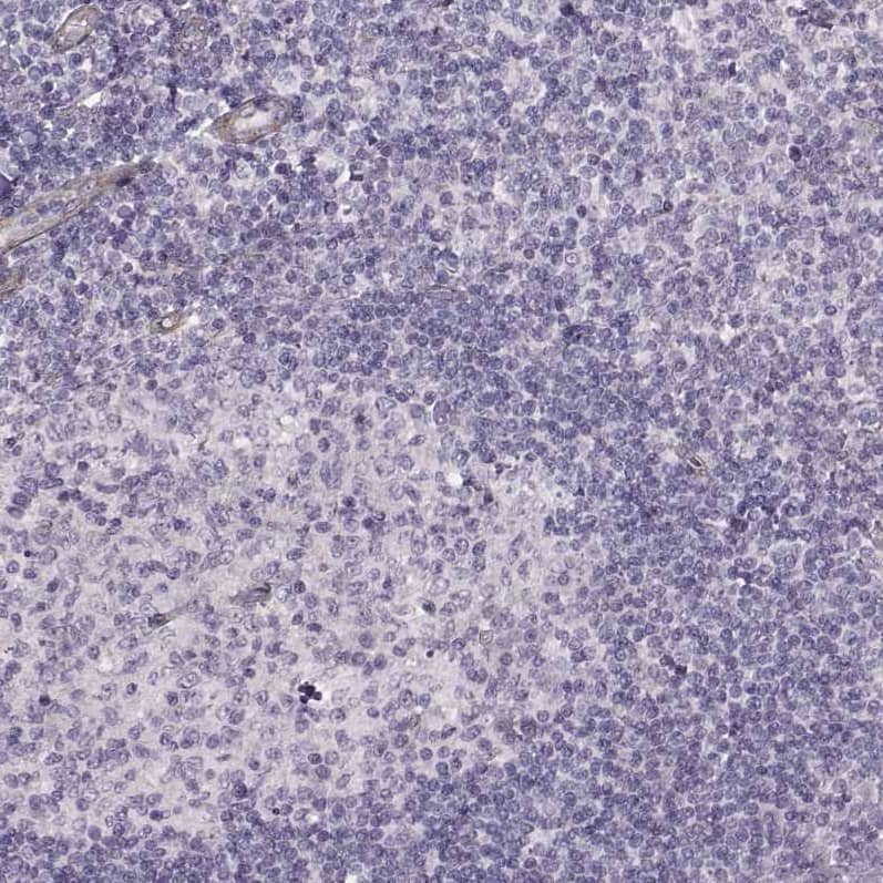 Staining of human tonsil shows no positivity in lymphoid cells as expected.