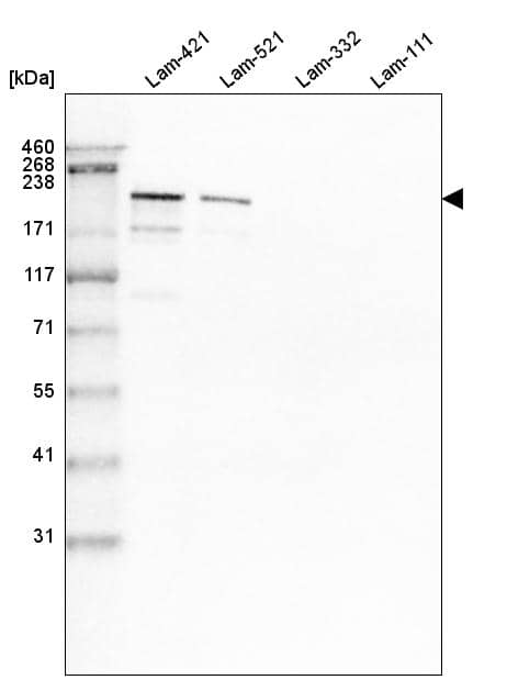 Analysis of purified human recombinant Laminin-421, Laminin-521, Laminin-332 and Laminin-111.