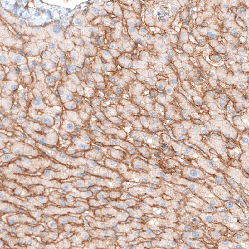 Staining of human liver shows moderate positivity in liver sinusoids.