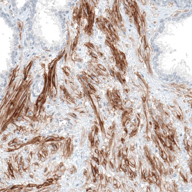 Staining of human prostate shows moderate to strong membranous positivity in smooth muscle cells.