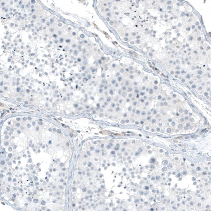 Staining of human testis shows no positivity in cells in seminiferous ducts as expected.