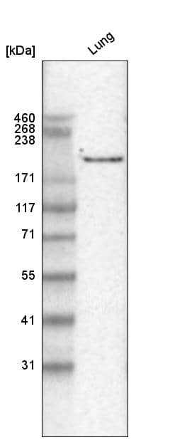 Analysis in human lung tissue.