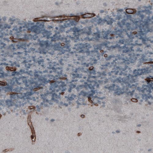 Staining of human cerebellum shows strong immunoreactivity in endothelium.