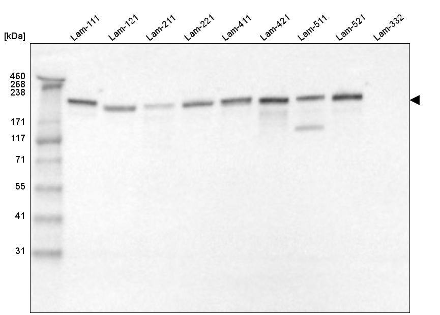 Analysis of purified human recombinant Laminin-111, Laminin-121, Laminin-211, Laminin-221, Laminin-411, Laminin-421, Laminin-511, Laminin-521 and Laminin-332.