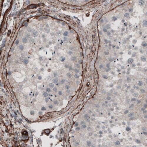 Staining of human testis shows strong positivity in basement  membrane in seminiferous tubules.