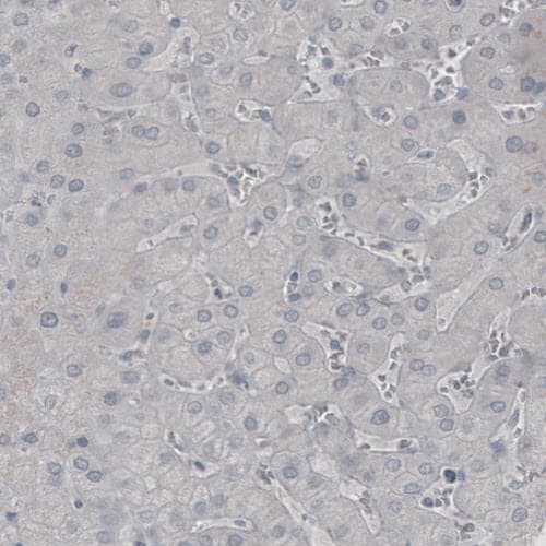 Staining of human liver shows absence of immunoreactivity in hepatocytes (negative control).