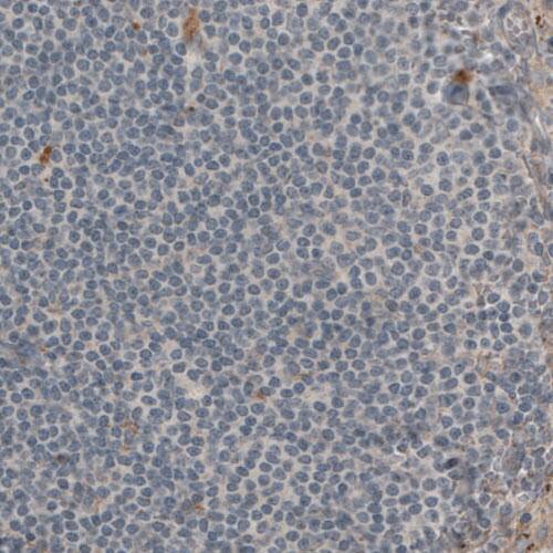 Staining of human lymph node shows absence of immunoreactivity in lymphoid cells (negative control).