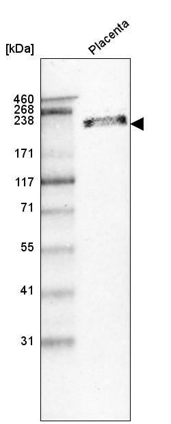 Analysis in human placenta tissue.