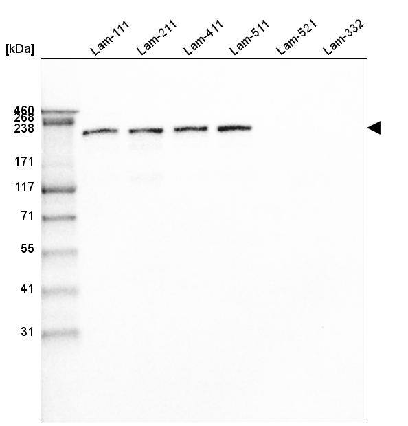 Analysis of purified human recombinant Laminin-111, Laminin-211, Laminin-411, Laminin-511, Laminin-521 and Laminin-332.