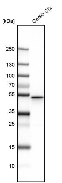 Analysis in mouse cerebral cortex tissue.