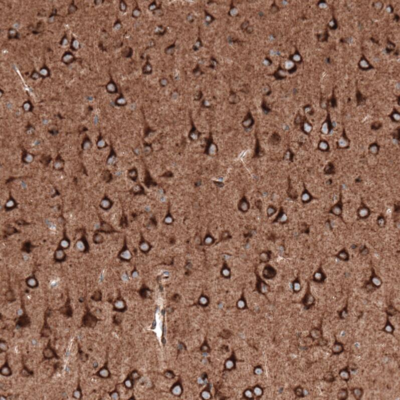 Staining of mouse cerebral cortex shows strong cytoplasmic positivity in neurons.