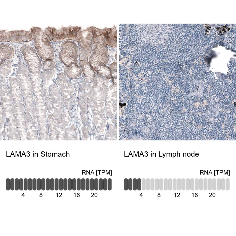 Analysis in human stomach and lymph node tissues using NBP3-44416 antibody. Corresponding Laminin alpha 3 RNA-seq data are presented for the same tissues.