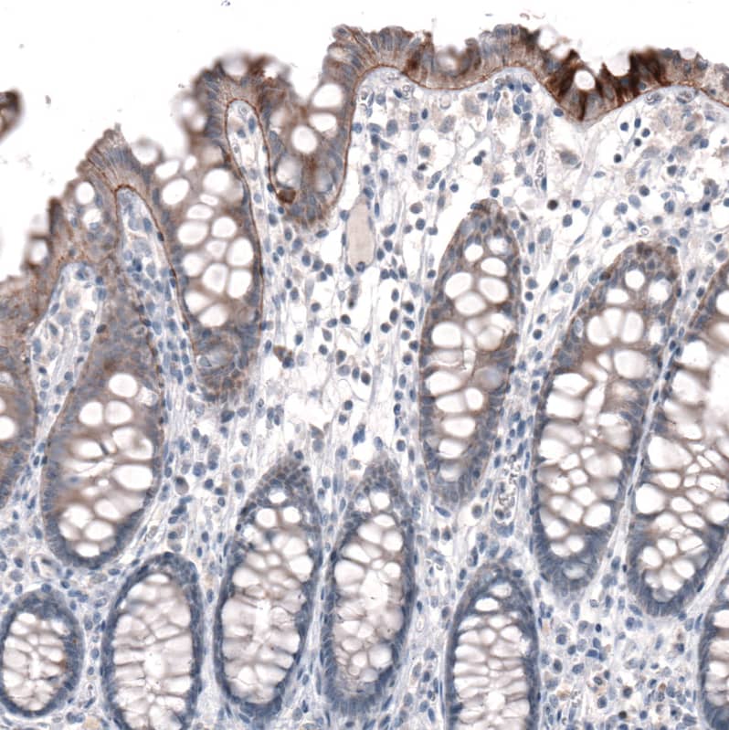 Staining of human colon shows moderate positivity in basement membrane of glandular cells.