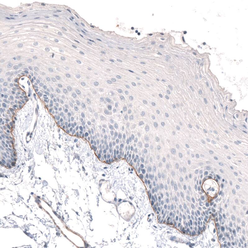 Staining of human oral mucosa shows moderate positivity in basement membrane of squamous epithelial cells.