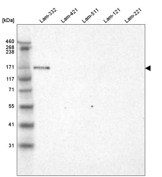 Analysis of purified human recombinant Laminin-332, Laminin-421, Laminin-511, Laminin-121 and Laminin-221.