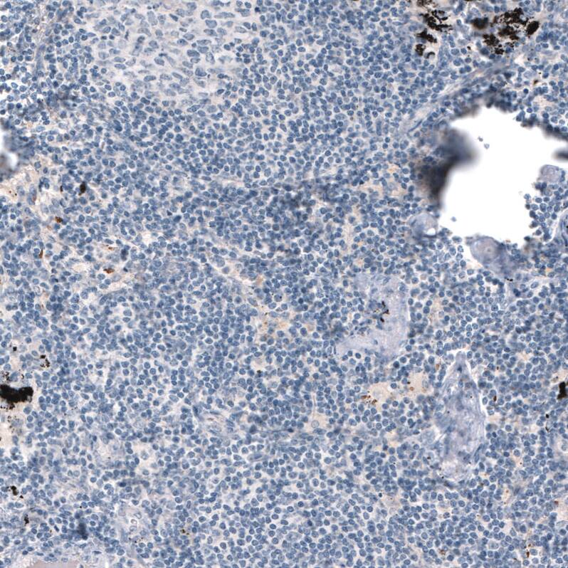 Staining of human lymph node shows no positivity in lymphoid cells as expected.