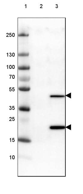 Lane 1: Marker [kDa] 250) Lane 3: Over-expression lysate (Co-expressed with a C-terminal myc-DDK tag in mammalian HEK293T cells)