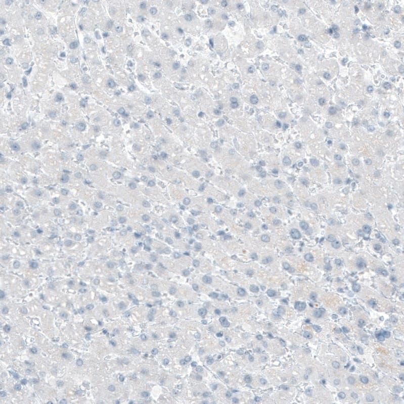 Staining of human liver shows no positivity as expected.