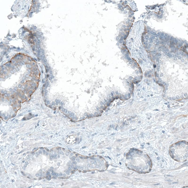 Staining of human prostate shows moderate positivity in basement membrane of glandular cells.