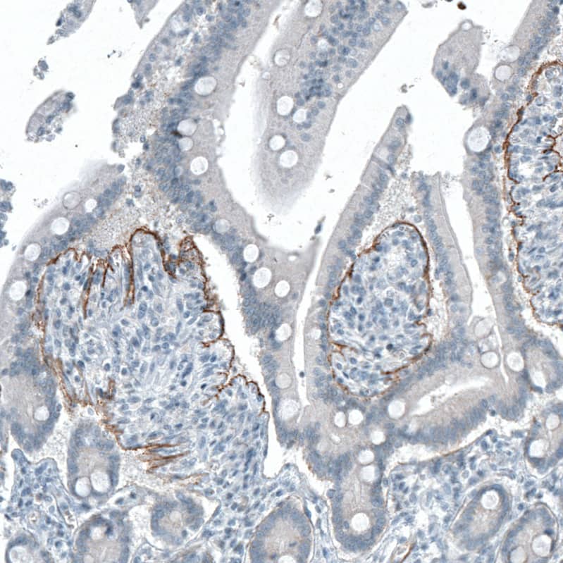 Staining of human small intestine shows moderate positivity in basement membrane of glandular cells.