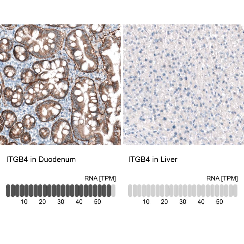 Analysis in human duodenum and liver tissues using NBP3-44420 antibody. Corresponding Integrin beta 4/CD104 RNA-seq data are presented for the same tissues.