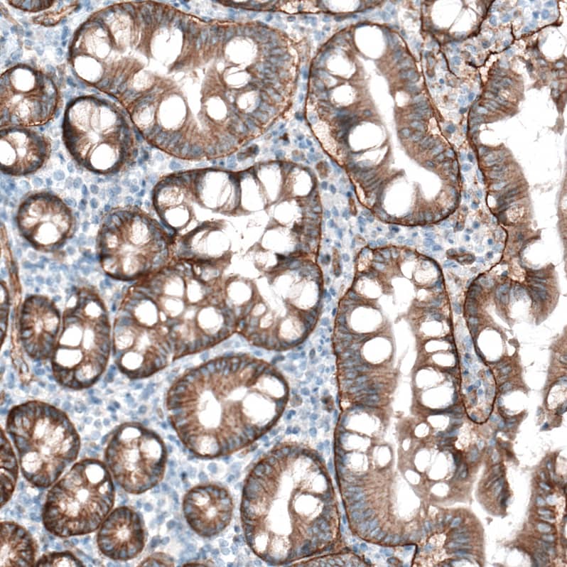 Staining of human duodenum shows moderate membranous immunoreactivity in glandular cells and strong positivity in basement membrane.