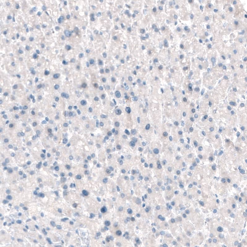Staining of human liver shows no positivity in hepatocytes as expected.