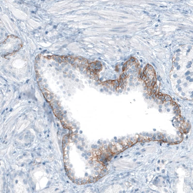 Staining of human prostate shows moderate membranous positivity in glandular cells.