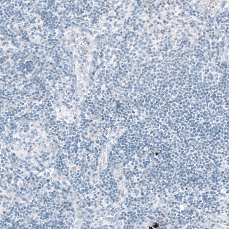 Staining of human lymph node shows no positivity in lymphoid cells as expected.