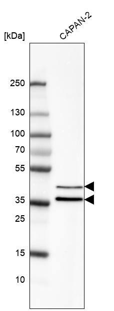 Analysis in human cell line CAPAN-2.