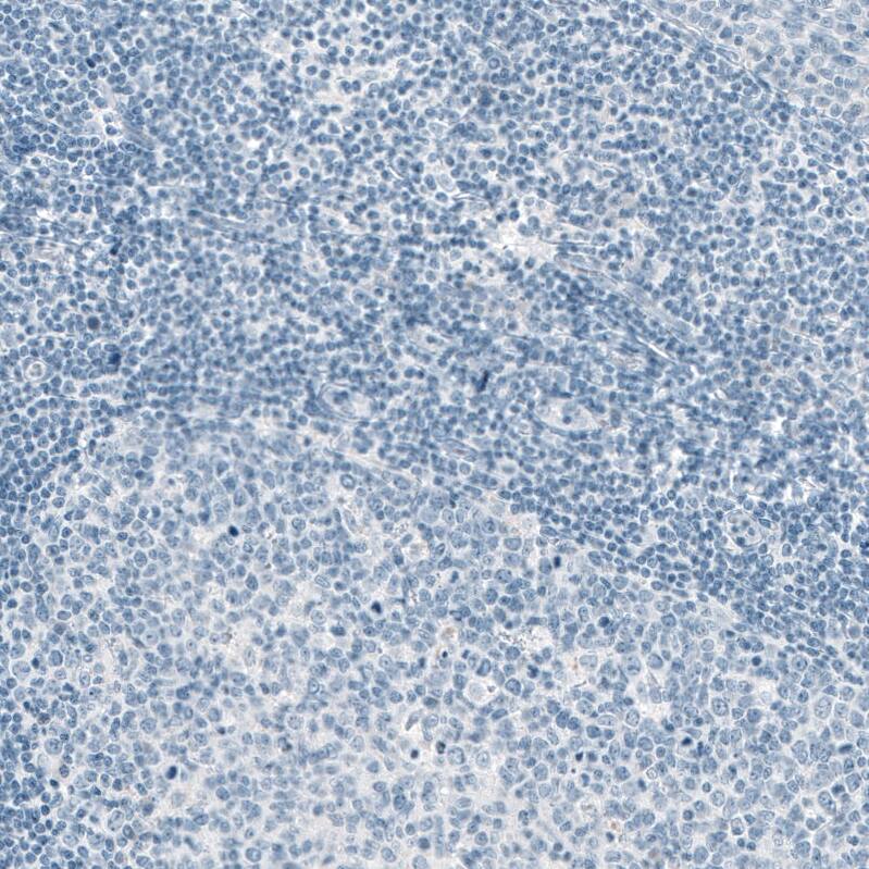 Staining of human tonsil shows no positivity in lymphoid cells as expected.