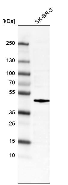 Analysis in human cell line SK-BR-3.
