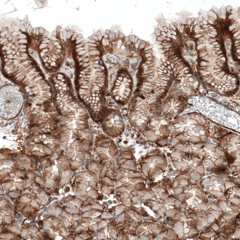 Staining of human stomach shows moderate membranous positivity in glandular cells.